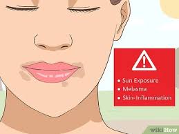 As you get older, hyperpigmentation becomes harder to treat because natural exfoliation is slowing down. 3 Ways To Get Rid Of The Dark Area Around The Mouth Wikihow