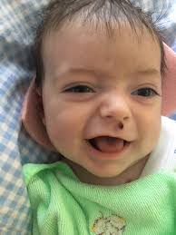 Simon Talbot is fundraising for DEBRA