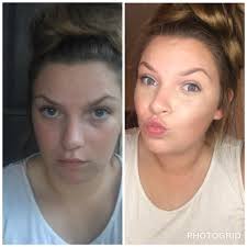 Wockeisha Got A Face Lift 😮‍💨⭐️