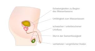 Krebs Im Alter Definition Krebsarten Symptome Pflege De
