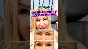 Facial Plastic Surgeon Podcasts Dallas