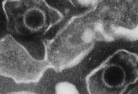 Este intalnita frecvent in randul adolescentilor si adultilor tineri, in special in cazul studentilor. Mononucleosis Mono Treatment Symptoms Diagnosis Complications Contagious