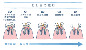 ãããæ­¯ã®é²è¡ç»åãã®ç»åæ¤ç´¢çµæ