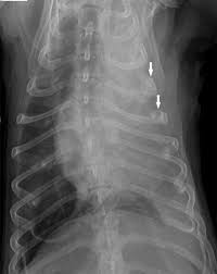 With the changing landscape of cancer diagnosis and treatment, increased areas of unusual metastases have been published as case reports. Invasive Pleural Malignant Mesothelioma With Rib Destruction And Concurrent Osteosarcoma In A Dog Acta Veterinaria Scandinavica Full Text