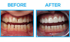 Gaßmann in hamburg, germany, is expert for dental implants and cosmetic dentistry. Best Cosmetic Dentist In Spring Tx Houston Area Family Dentist