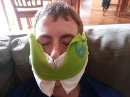 I Just Had My Wisdom Teeth Removed Thank You Reddit And My Sister For This Idea Post Wisdom Teeth Removal Wisdom Teeth Recovery Wisdom Teeth
