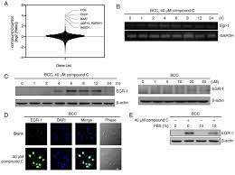 Your magicolor 4695mf is specially designed for optimal performance in windows, macintosh and linux environments. Egr 1 Plays A Protective Role In Ampk Inhibitor Compound C Induced Apoptosis Through Ros Induced Erk Activation In Skin Cancer Cells