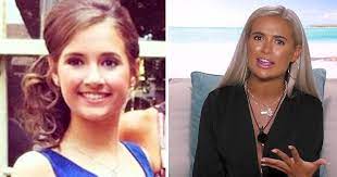 Cosmetic filler for young women should not be normalised. Molly Mae Transformation Love Island Star Unrecognisable In Old Pictures