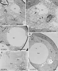 We did not find results for: Electron Microscopic Analysis Of The Bfainduced Formation Of Large Download Scientific Diagram