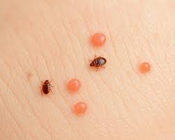 Image result for bedbugs bites