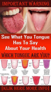 What Your Tongue Can Tell You About Your Health Health Told You So Natural Health