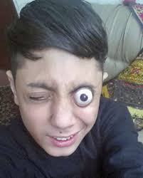 Kinh dị người phụ nữ tự do điều khiển nhãn cầu lồi hẳn ra ngoài