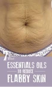 How To Deal With Loose Skin After Losing Weight Naturally One Of The Most Frustrating Aspects Of Skin Tightening Essential Oil Best Essential Oils Loose Skin