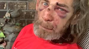 Fundraiser by Patricia Nagy : Help Jose Heal and Keep His Family Afloat