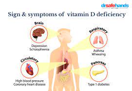 Signs and Symptoms of Vitamin D Deficiency | DrSafeHands