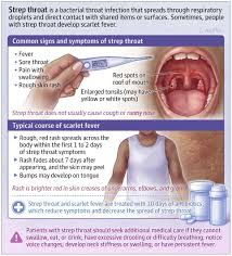 Image result for Strep throat infection roof of mouth