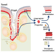 Image result for tonsilla palatina