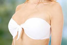 Zur zeit halte ich mich an den diät plan und mache leichte sporttätigkeiten wie fahrradfahren und am stepper. Brustvergrosserung Heilungsverlauf Fragen