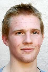 Benicia High wrestler Joe Hurst is the Athlete of the Week