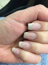 Do not apply the next pair of acrylic nails sooner than a week after the removal. Acrylic Nail How To Remove