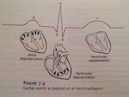 Electrocardiogram Vet Tech Student Vet Tech School Vet Medicine