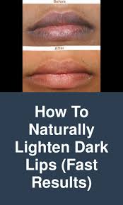 How To Naturally Lighten Dark Lips Fast Results Darklips Liplightening Sugar Salt Oliveoil Honey Dark Lips Remedies For Dark Lips Lip Lightening