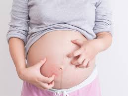 That person is considered pregnant, no matter how far along in that pregnancy the in it's very possible for a woman to give birth to ten babies in her lifetime. The Difference Between An Itchy Belly And Obstetric Cholestasis