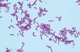 Salmonella gram stain and shape. Figure 5 Gram Stain Of Salmonella Typhimurium Harnessing The Power Of Microbes As Therapeutics Bugs As Drugs Ncbi Bookshelf