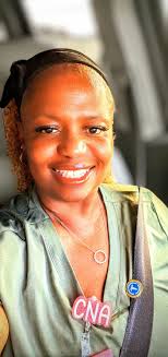 Kidney transplant before and after pictures