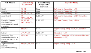 you will love 12 lead reciprocal changes chart 2019