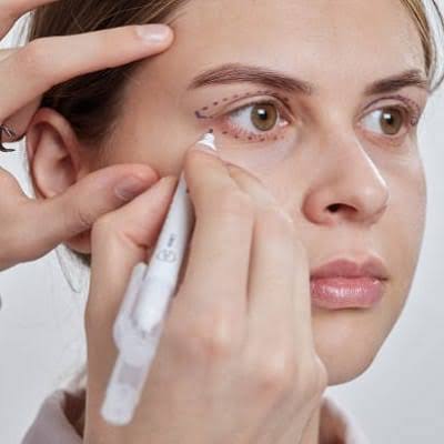 Eyelid Surgery in Islamabad &amp;amp; Pakistan | Blepharoplasty
