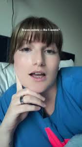 5 Weeks with Braces Difference