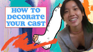 See more ideas about cast decoration, leg cast, broken ankle. All A Bao Creativity Ep 1 How To Decorate Your Cast Cast Decoration Vlog Youtube