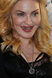 Grill and bare it: heavy metal mouthwear goes mainstream