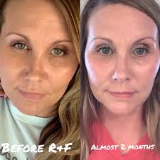 What are your thoughts