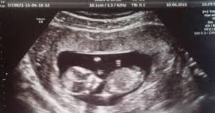 Bebeğin cinsiyetini tahmin etmenin eğlenceli yolları. 9 10 11 12 13 14 15 16 17 Haftalik Gebelikte Cinsiyet Belli Olurmu