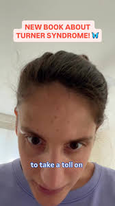 Meet the author behind our new book about Turner syndrome, The Tiny  Butterfly! 🦋, Maria Sendik is a proud TS woman, Special Olympics athlete,  and now, children’s book author!, Maria was diagnosed with ...