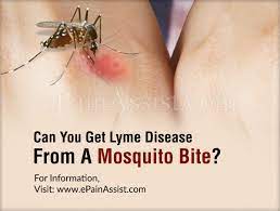 Can You Get Lyme Disease From A Mosquito Bite