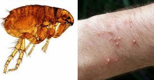 Fleas found in human hair can lead to the following symptoms: Fleas Aren T Just A Problem For Pets Here S How To Get Rid Of Them