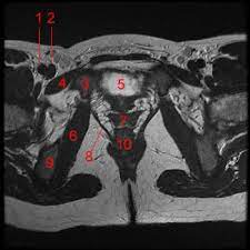 We did not find results for: Mri Of The Female Pelvis W Radiology