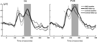 Unlike clinical trials for exudative amd, it is impractical to use the change in visual acuity (va) as a primary endpoint for the study of nonexudative amd. Anti Vascular Endothelial Growth Factors Treatment Of Wet Age Related Macular Degeneration From Neurophysiology To Cost Effectiveness Vottonen 2018 Acta Ophthalmologica Wiley Online Library