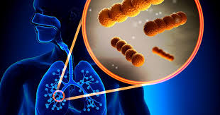It's a monoclonal antibody, which is a biologic drug that's made from immune system cells. Cf Patients With Lung Allergy From Fungi Respond Well To Xolair Study Says