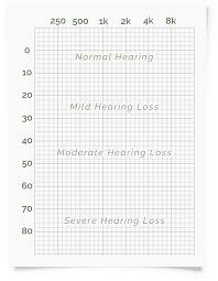 Online Hearing Test Audiogram Printout