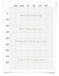 online hearing test audiogram printout