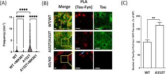 MAPT-A152T mutation drives neuronal hyperactivity through Fyn-NMDAR  signaling in human iPSC-Derived neurons: Insights into Alzheimer's  pathogenesis