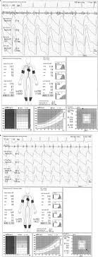 Full Text Pitfalls In The Ankle Brachial Index And Brachial