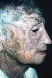 Plastic Surgical Dental