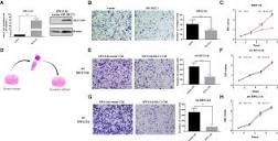 Frontiers | DLC1 inhibits colon adenocarcinoma cell migration by ...
