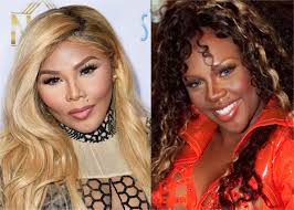 Lil' Kim's New Face: A Plastic Surgeon Weighs In