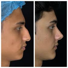 Jornada Carioca de Cirurgia Plástica 2025 Rio de Janeiro, Brasil 🇧🇷 Such  a great honor to participate in one of the most important events of plastic  surgery in the world. #firstclassplasticsurgery #bellanovaclinic #